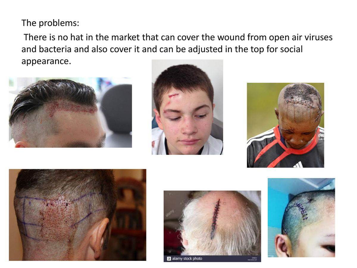 ComfyFit problem definition after head surgery